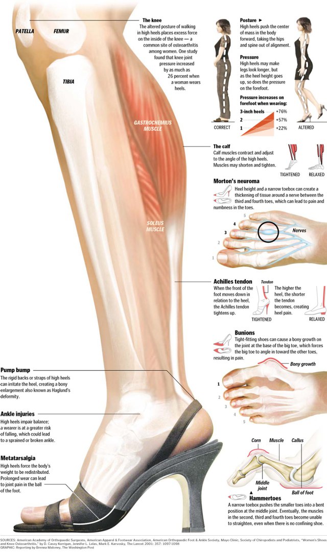 Anatomy of a High Heel & Parts You Need to Know