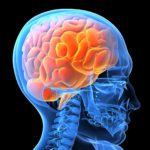 Do Placebos Really Work? Studies Show Amazing Effects 50