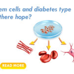 stem cells diabetes type 1