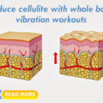 cellulite