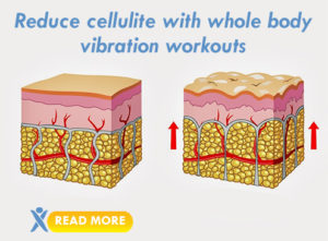 cellulite