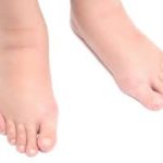 Why Your Feet and Ankles Swell 26
