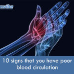poor-blood-circulation-signs