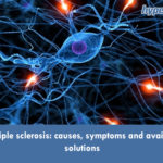 Multiple sclerosis: causes, symptoms and available solutions