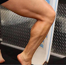 knee img