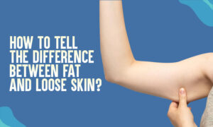 How to Tell the Difference Between Fat and Loose Skin? 1