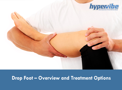 Drop Foot – Overview and Treatment Options