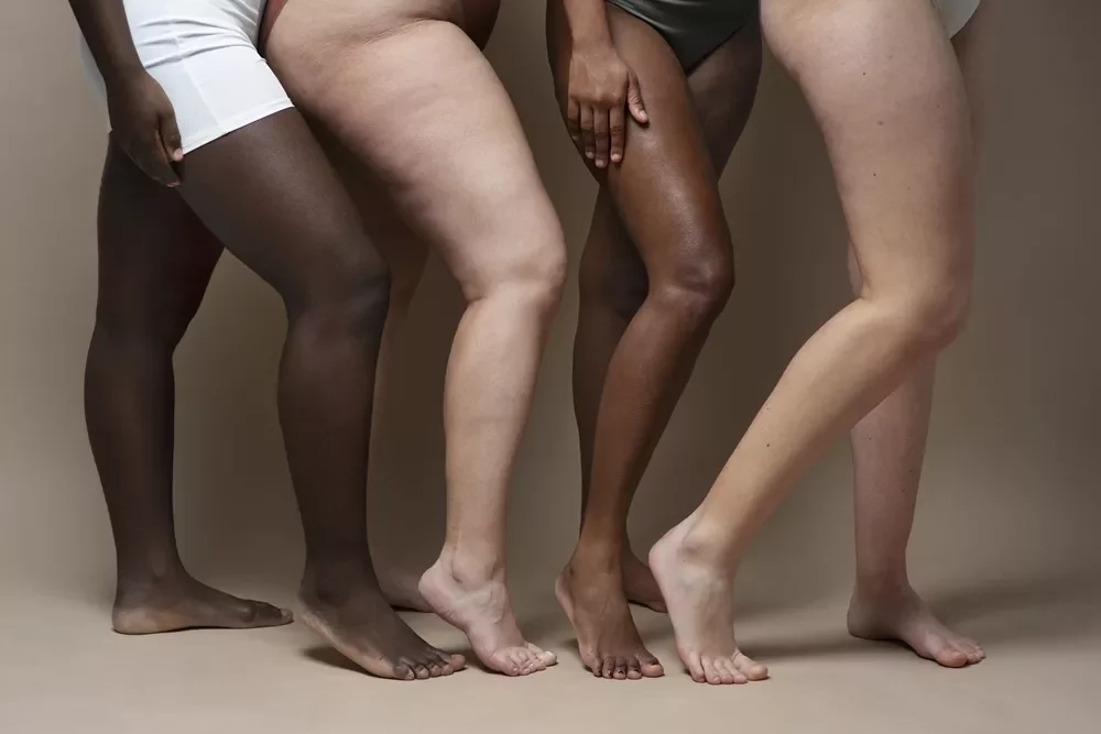 Close-up of diverse women’s legs showing natural cellulite and different skin tones.