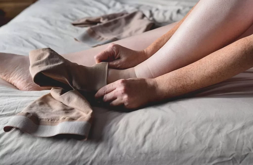 putting on compression socks for leg swelling relief Close-up of hands pulling on beige compression socks over pale lower legs while sitting on a bed.