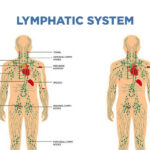 lymphatic massage side effects