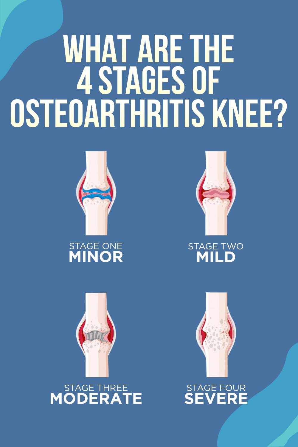 vibration therapy for knee pain